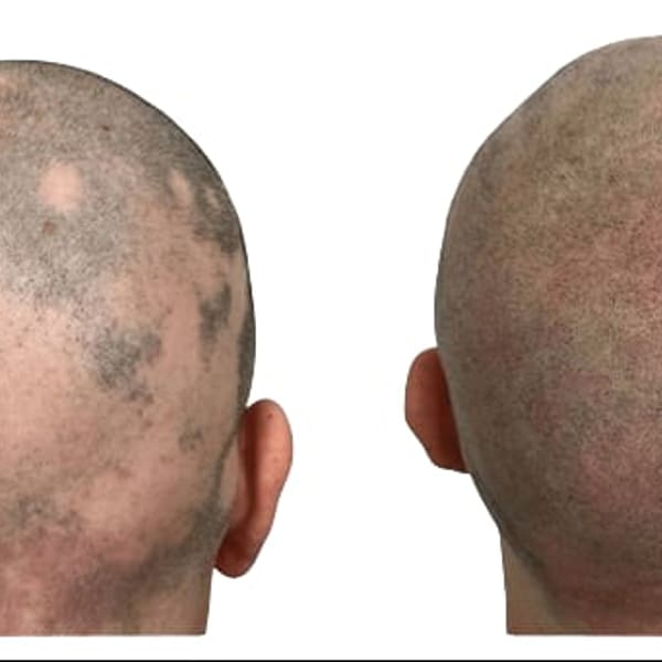 3D Camouflage AZ - permanent makeup in Phoenix, AZ