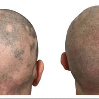 3D Camouflage AZ - permanent makeup work