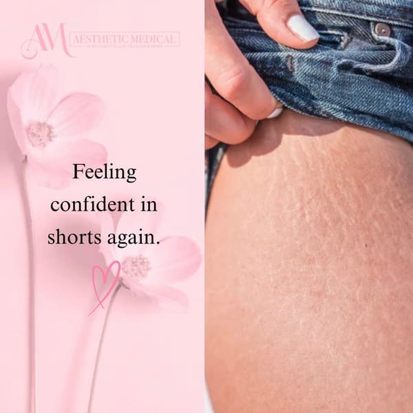 Aesthetic Medical Tattooing - permanent makeup in Fresno, CA