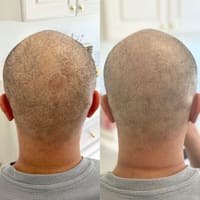 Aesthetic Micropigmentation - permanent makeup work