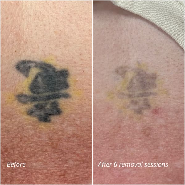 Aesthetics & PMU by Lo - permanent makeup in Loveland, CO