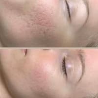 Ageless Beauty Rx - permanent makeup work