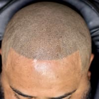 Angel Scalp Micro - permanent makeup work
