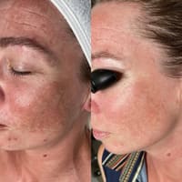 Anita's Skin Care Clinic - permanent makeup work
