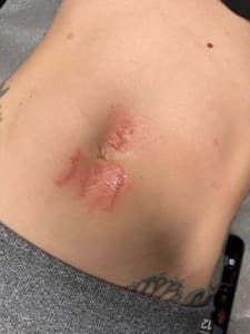 Areola Tattoo result by Allmon Artistry in Knoxville, TN