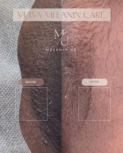 Areola Tattoo result by Aura Studio in Buena Park, CA