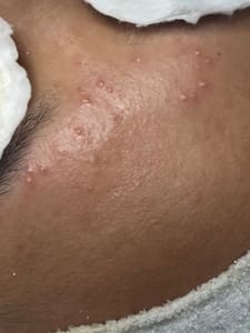 Areola Tattoo result by BBL in Chula Vista, CA