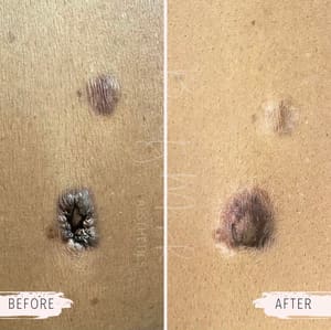 Areola Tattoo result by Beauty Mark Dallas in Dallas, TX