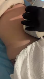 Areola Tattoo result by Bella Derma Boca Spa in Boca Raton, FL