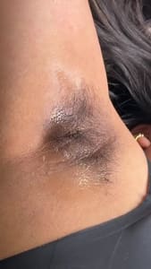 Areola Tattoo result by Bella Skin Waxing & Esthetics in East Brunswick, NJ