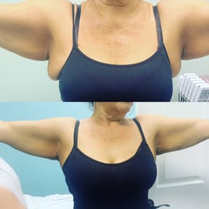 Areola Tattoo result by Bellissima bodysculpting. in Whittier, CA