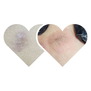 Areola Tattoo result by Brow Babe Microblading L.L.C in Lewiston, ID