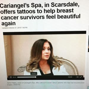 Areola Tattoo result by Cariangel's Cosmetic and Medical Spa in Scarsdale, NY