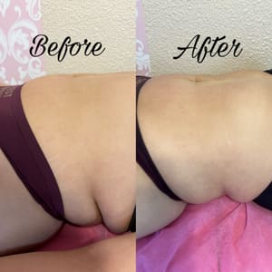 Areola Tattoo result by Celi Beauty Bar in San Diego, CA