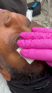 Areola Tattoo result by Changing Faces Makeup in Delray Beach, FL