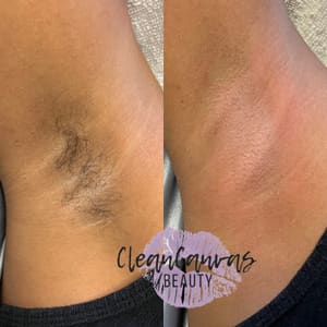 Areola Tattoo result by Clean Canvas Beauty in Kenner, LA