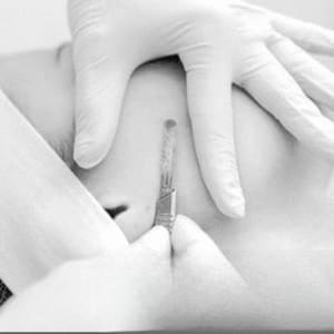 Areola Tattoo result by Elite Esthetics Beauty & Wellness Studio, LLC in Turlock, CA