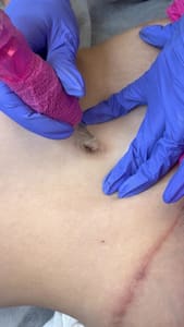 Areola Tattoo result by Esthetics by Love Bee in Englewood, NJ