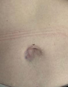 Areola Tattoo result by Glow Cosmetic Tattoo Studio in Ellicott City, MD