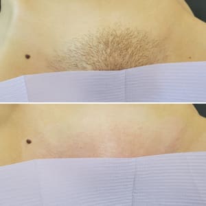 Areola Tattoo result by Hailey Thaine Esthetics in Elizabethtown, KY