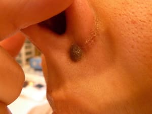 Areola Tattoo result by Hair Free Skin - Dallas Electrolysis & School in Dallas, TX
