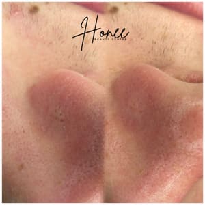 Areola Tattoo result by Honee Beauty Center in Selbyville, DE