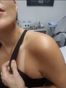 Areola Tattoo result by Illustrious Therapeutics in Glendale, CO