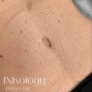 Areola Tattoo result by INKology in Redlands, CA