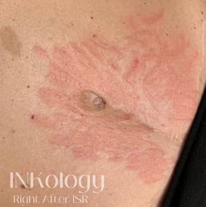 Areola Tattoo result by INKology in Redlands, CA