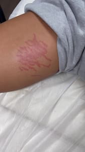 Areola Tattoo result by JB Beautyy in Patchogue, NY