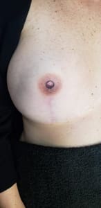 Areola Tattoo result by LISA OM Dallas Studio & Academy in Dallas, TX