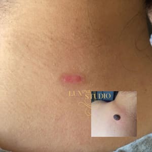 Areola Tattoo result by Lux Studio in San Diego, CA