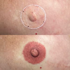 Areola Tattoo result by Makeup by Mandie in Sacramento, CA