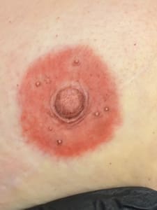 Areola Tattoo result by Mandee Best Permanent Cosmetics & Piercings in Alliance, NE