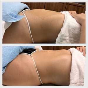 Areola Tattoo result by Maribel's Magic in Culver City, CA
