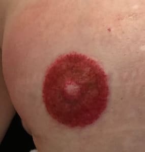 Areola Tattoo result by Mona Lisa’s Permanent Makeup & Training Center in Hamilton, OH