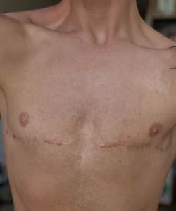 Areola Tattoo result by Own Your Journey Studio in Dana Point, CA