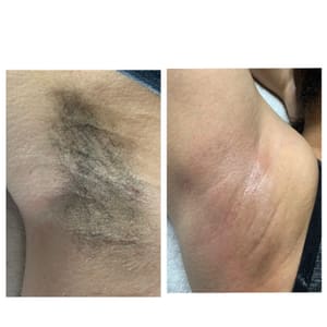 Areola Tattoo result by Perfect Imperfection LLC in South Milwaukee, WI