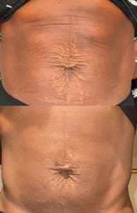 Areola Tattoo result by Proud Brow in Guerneville, CA