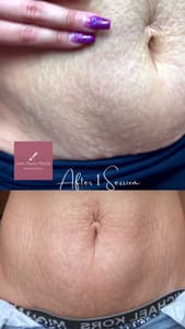 Areola Tattoo result by Queen Beauty Medink in San Diego, CA