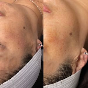 Areola Tattoo result by Rain On Me Beauty, LLC in El Mirage, AZ