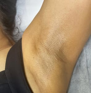 Areola Tattoo result by Rosy Radiance in Edgewater, CO