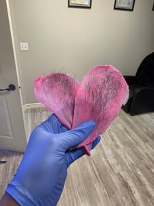 Areola Tattoo result by Skin and Beauty Therapy in Ammon, ID