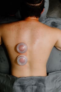 Areola Tattoo result by Skinderella Aesthetics in Titusville, FL
