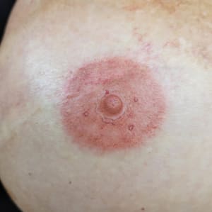 Areola Tattoo result by STAy INK’d in St Augustine, FL