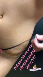 Areola Tattoo result by Surreal Tan in Elmhurst, IL