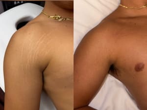 Areola Tattoo result by Ventura Ink Studio LLC in Fredericksburg, VA