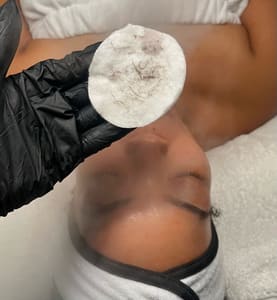 Areola Tattoo result by VS Aesthetics in Tampa, FL