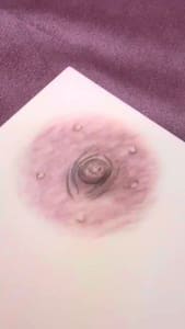 Areola Tattoo result by YDerma Clinica in Apollo Beach, FL