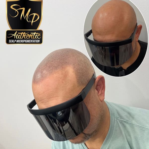 Authentic Scalp Micropigmentation - permanent makeup in Plainfield, IL